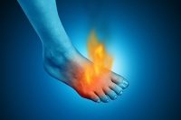 Neuropathy and Burning Feet
